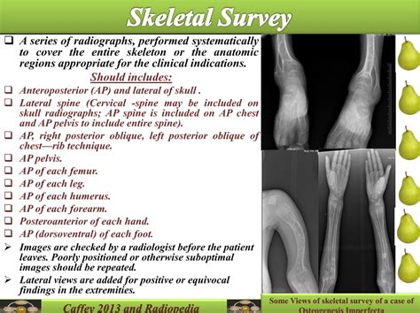 Easy Radiology: Skeletal survey & joint radiograph checklist