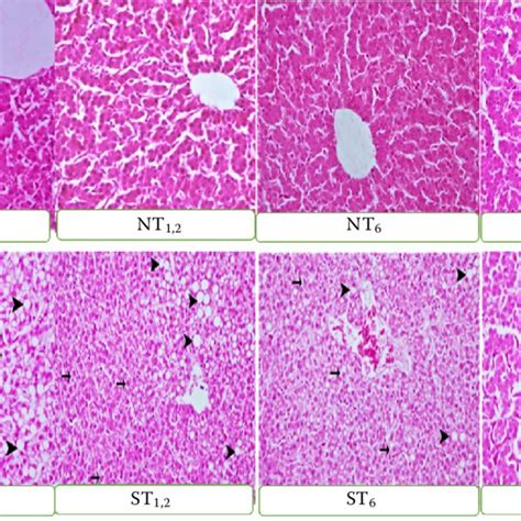 Histopathological View Of The Liver Tissue × 40 Hande Download Scientific Diagram