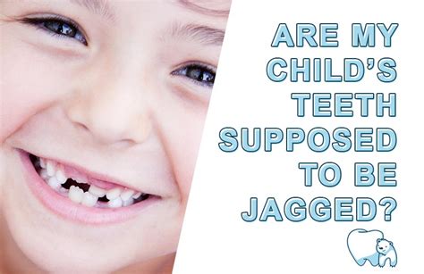 Why Are New Permanent Teeth Jagged - TeethWalls