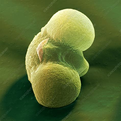 Pollen Grain Of Scot S Pine Stock Image B786 0562 Science Photo