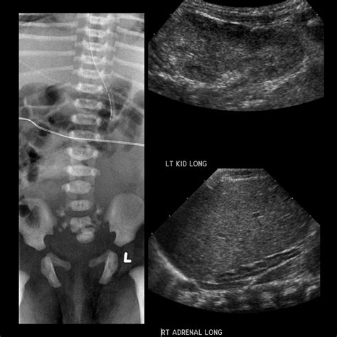 Pediatric Vertebral Body Anomalies | Pediatric Radiology Reference