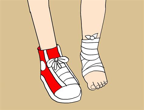 Au Mistys Bandaged Foot By Animedino1 On Deviantart