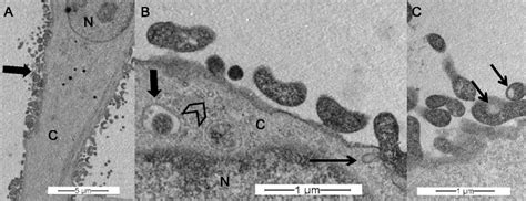 Transmission Electron Microscopy Of PECT Cells Infected With M Bovis