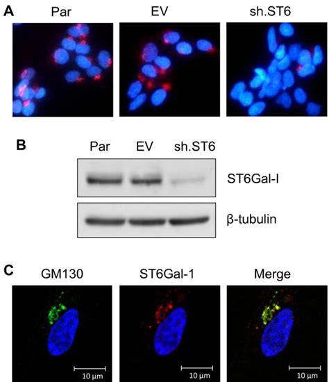 St Gal I Knockdown In Pa Ovarian Cancer Cells Pa Cells That Have