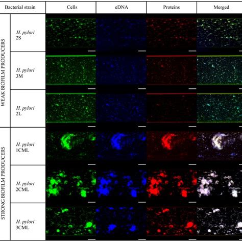 Representative Fluorescence Microscopy Photographs Of Biofilms Produced