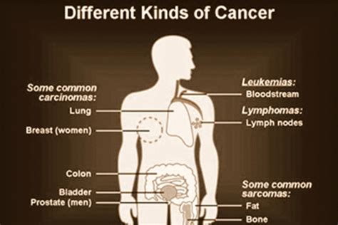 Understanding Cancer Series Part2 Different Kinds Of Cancer Faculty