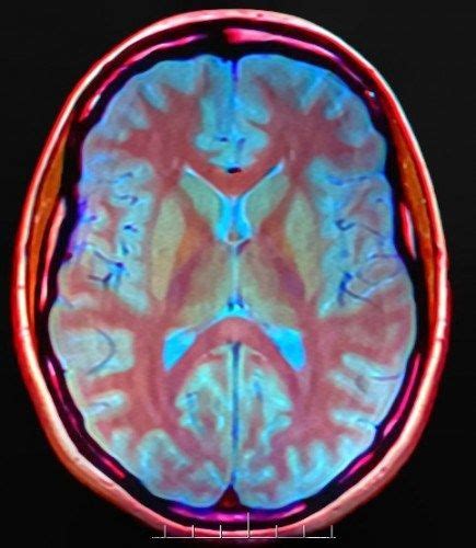 Neuroscience Of Mindfulness Default Mode Network Meditation