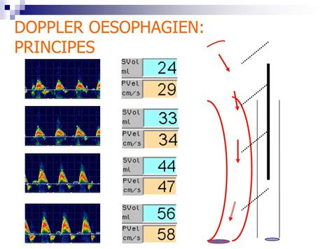 Ppt Principes Indications Et Limites Des Explorations Par Doppler