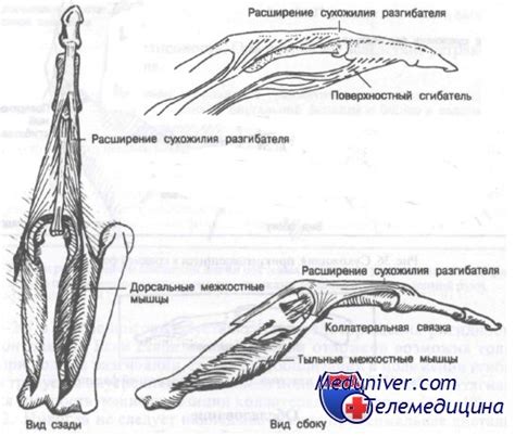 Переломы средней и проксимальной фаланг пальцев кисти. Диагностика и ...