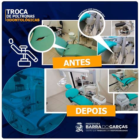 Prefeitura Adquire Novas Poltronas Odontol Gicas Para Ubss De Barra