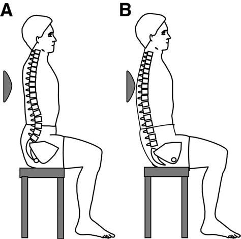 Anterior Pelvic Tilt Exercise Health Benefits Correction And How To Do