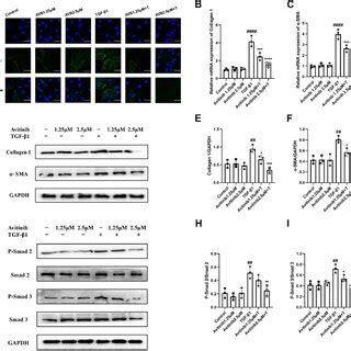 Avitinib inhibits fibroblasts activation via TGF β1 Smad signaling