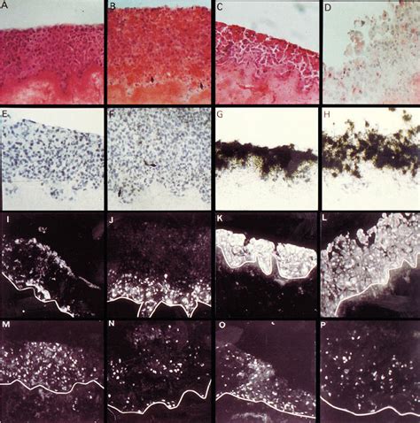 Transfection Of A431 Cells With Constitutive C Fos Or C Fos C Jun