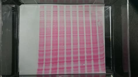 Can You Show The Picture Of Your Worst Western Blot And Explain The