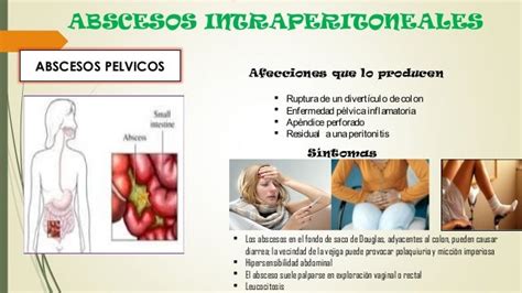 Absceso Intraperitoneal