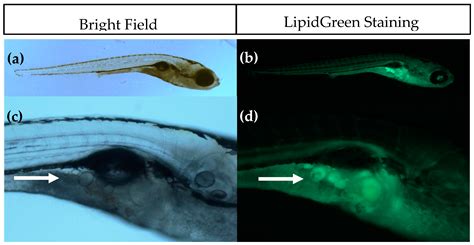 Ijms Free Full Text Altered Adipogenesis In Zebrafish Larvae