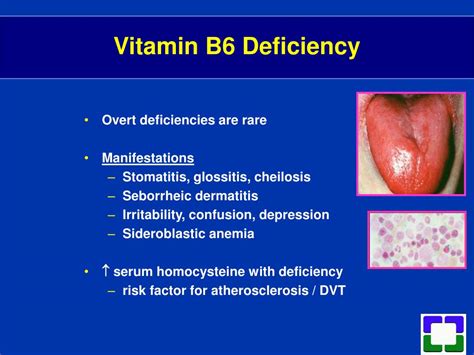 Vitamin B6 Deficiency Symptoms In Adults