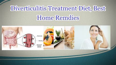 Diverticulitis Treatment Diet Best Home Remdies Youtube