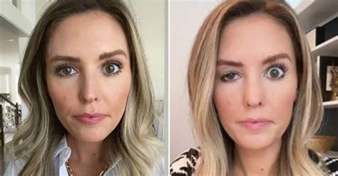 People In The Botched Surgeries Reddit Share Pictures Of Their