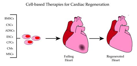 Ijms Free Full Text Cell Based Therapies For Cardiac Regeneration