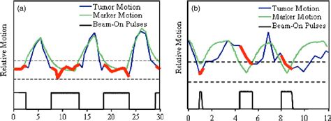 Figure 4 From The Management Of Respiratory Motion In Radiation