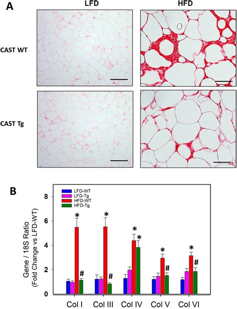 Cast Overexpression Reduced Interstitial Fibrosis In Adipose Tissue