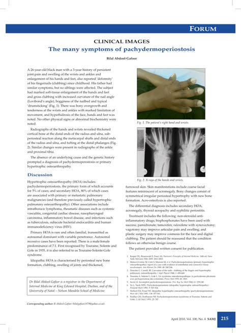 (PDF) The many symptoms of pachydermoperiostosis