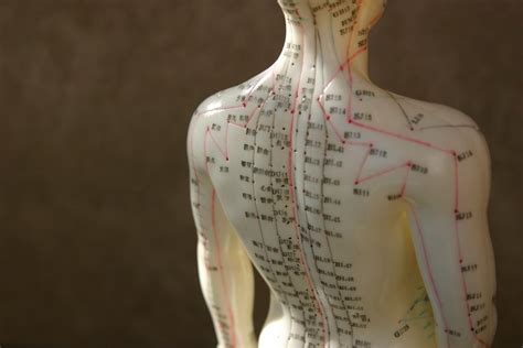 Acupuncture For The Treatment Of Sciatica Como Lake Chiropractic