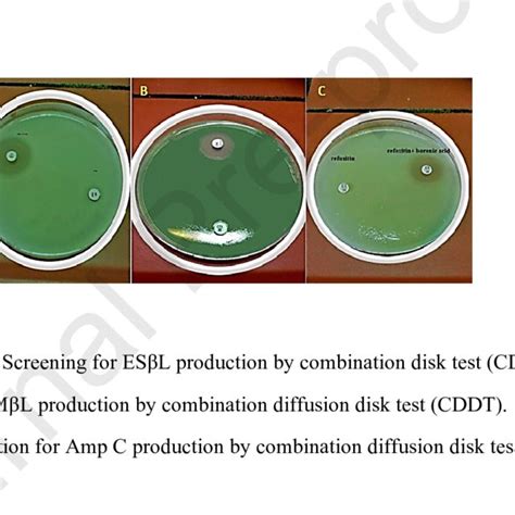 Kirby Bauer Disc Diffusion Method For Antibiotic Susceptibility Test Of Download Scientific