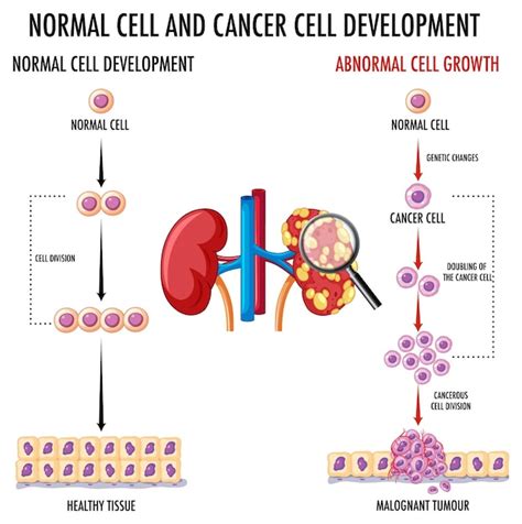 Diagramme Montrant Une Cellule Normale Et Une Cellule Cancéreuse Vecteur Gratuite