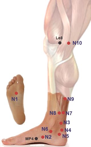 Acupuncture For Ganglion Cysts Artofit