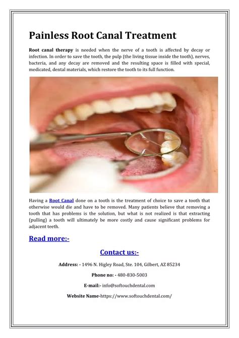 Ppt Painless Root Canal Treatment Powerpoint Presentation Free