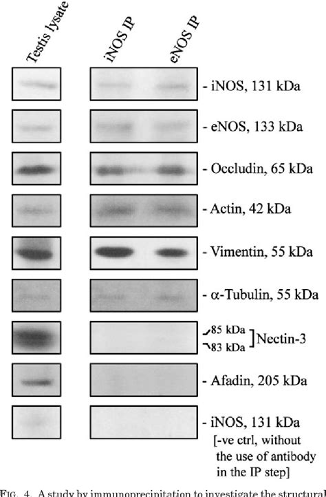 Figure From Regulation Of Sertoli Cell Tight Junction Dynamics In The