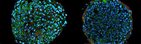 Three Dimensional D Spheroid Assay Creative Bioarray Cellassay