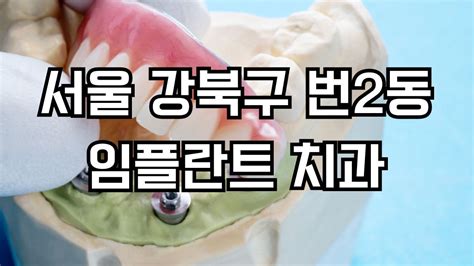 서울 강북구 번2동 임플란트 치과 잘하는곳 가격 비용 저렴한곳 싼곳 유명한곳 Top 2 장점 단점 후기 주의사항 놓치지