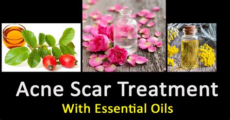 Essential oils for acne scars, how to use them? - Helpela