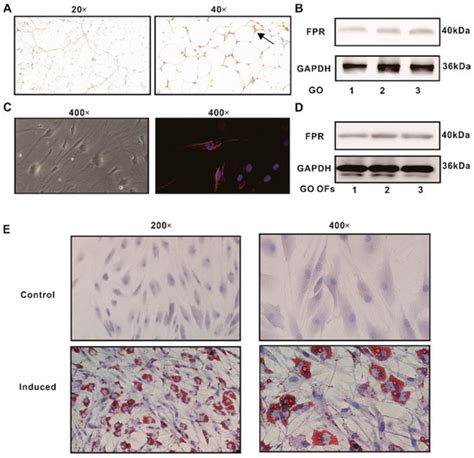 Ijms Free Full Text Prostaglandin F2α Regulates Adipogenesis By