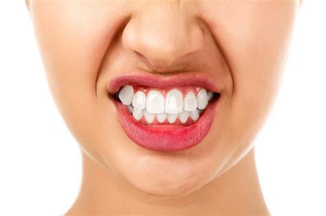 Managing Bruxism Teeth Grinding Castlemill Dental Clinic