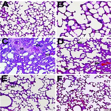 Hematoxylin Eosin Staining In The Lung Tissues Of Rats In All Groups