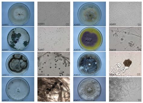 The Morphology Colony Appearance Conidia And Hypha Of Some Download Scientific Diagram