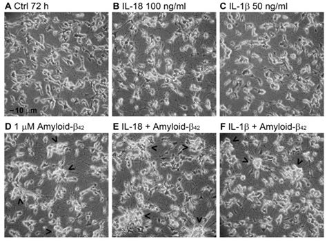 The appearance of differentiated SH SY5Y cells after IL 18 or IL 1β