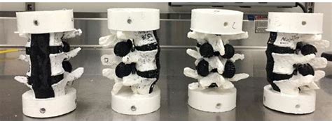 Four Different Synthetic Spine Models Shown Left To Right In