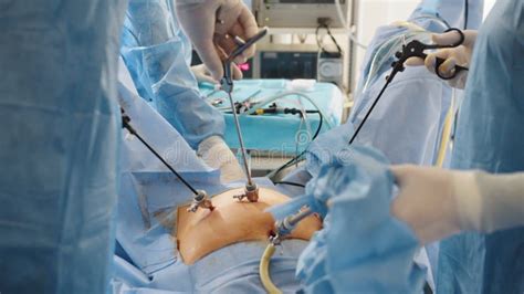 Medical Team Performing Surgical Operation In Hospital Operating The