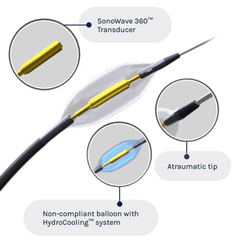 Ultrasound Renal Denervation Meets Primary Efficacy Endpoint In