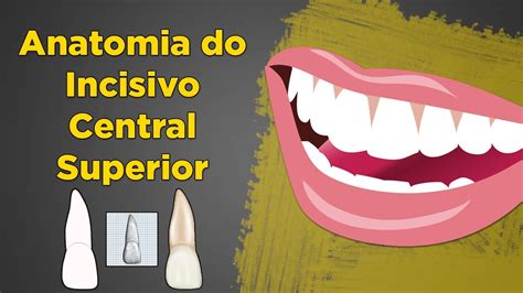 Anatomia Do Incisivo Central Superior Resumo De Anatomia Dental