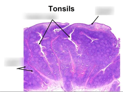 Pharyngeal Tonsil Histology