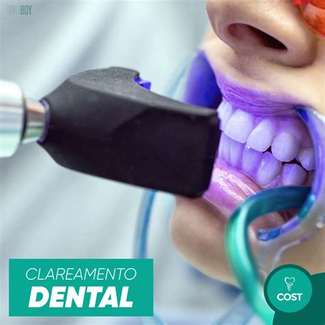 Novo Clareamento Dental A Laser Valor Tend Ncia