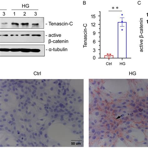 High Glucose Hg Level Upregulates Tenascin C Tnc And Active