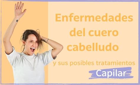 Enfermedades Del Cuero Cabelludo 3 Principales Que Debes Cuidar