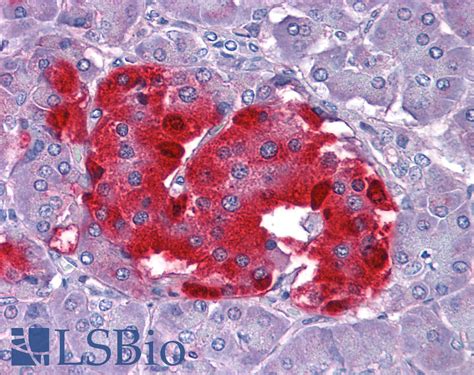 IHC Plus CHGA Chromogranin A Polyclonal Antibody Goat LSBio